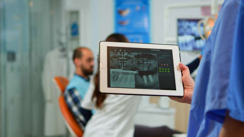 Dental Implants